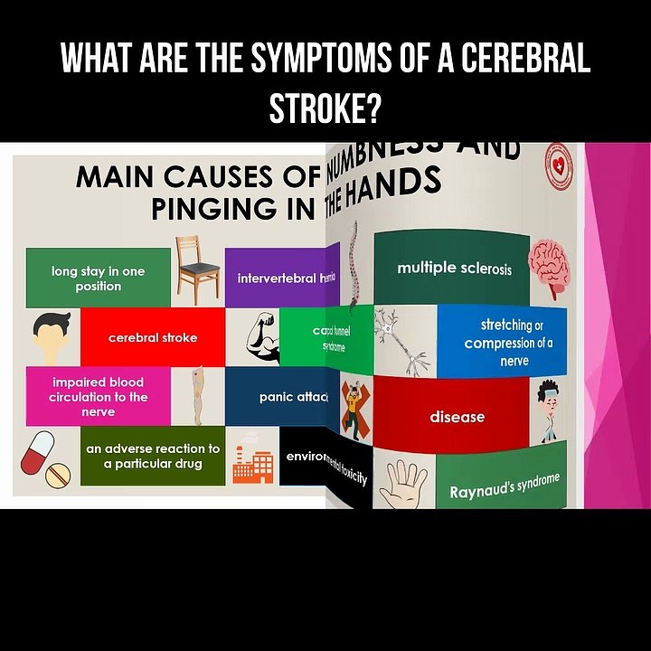 What are the symptoms of a cerebral stroke?