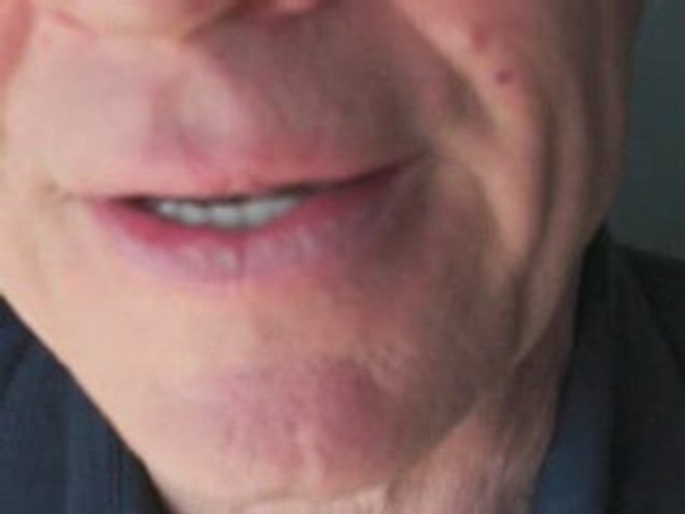 Gum Disease: The Truth About Gum Disease