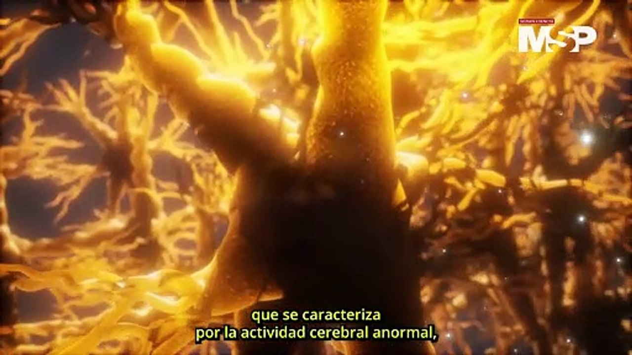 ¿Qué es la epilepsia y cómo funciona? - #ExclusivoMSP