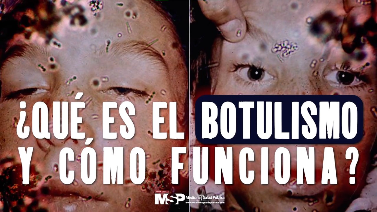 ¿Qué es el botulismo y cómo funciona? - #ExclusivoMSP
