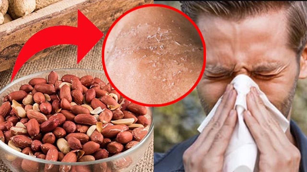 सर्दियों में मूंगफली खाने से क्या होता है | Sardiyo Me Mungfali Khane Se Kya Hota Hai | Boldsky