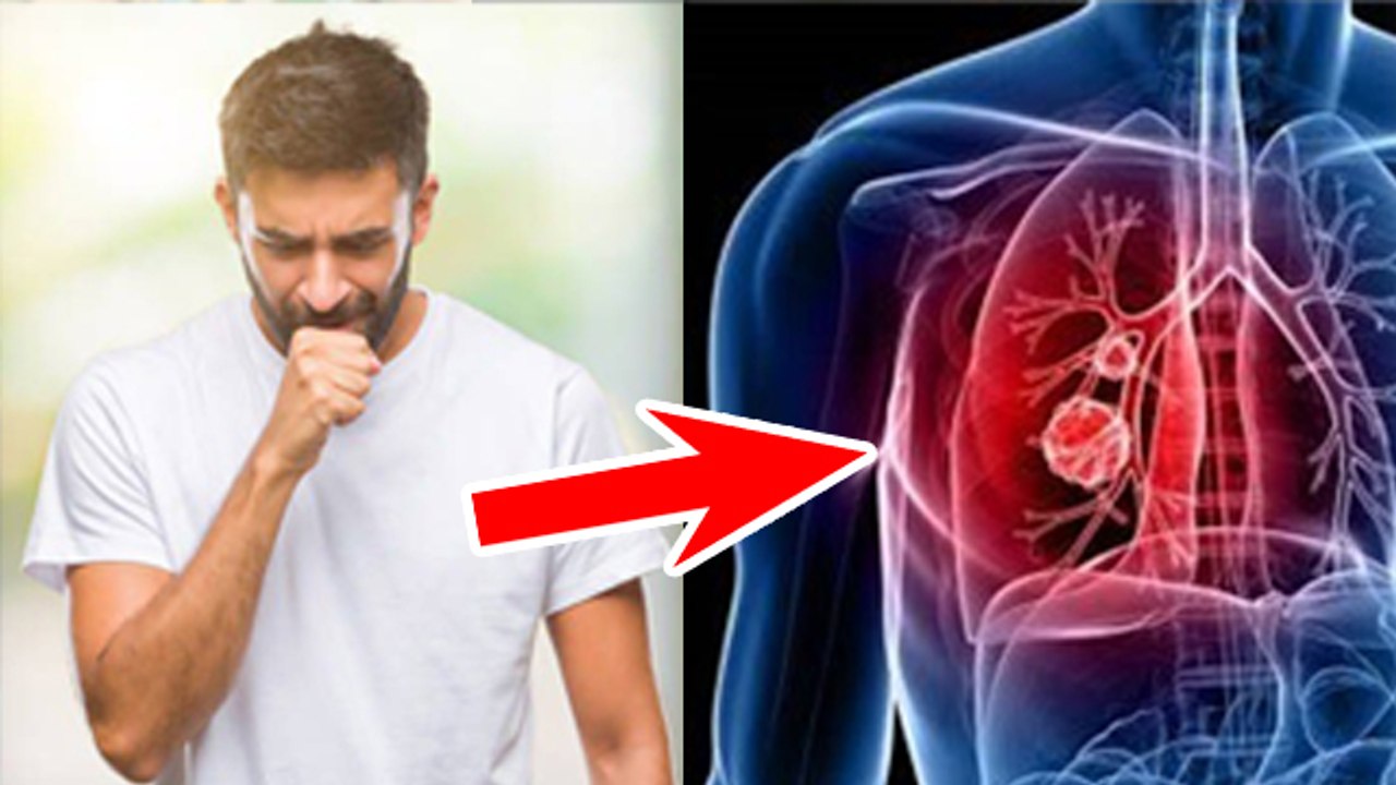 क्या फेफड़ों का कैंसर जेनेटिक होता है | Is Lung Cancer Genetic Or Heridatory |Boldsky