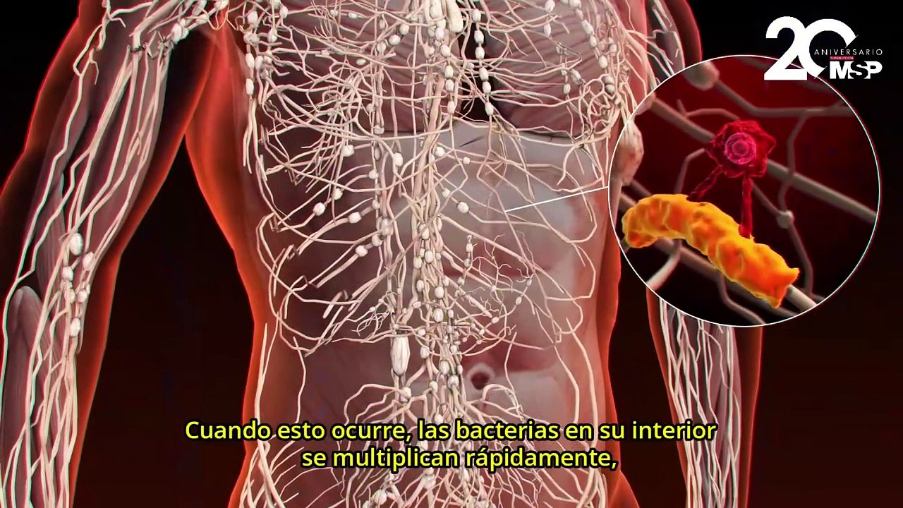 ¿Cómo funciona la apendicitis?