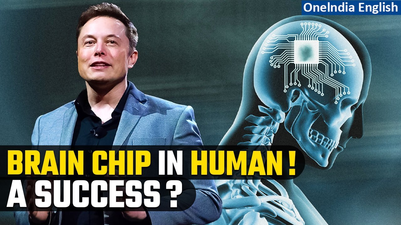 Elon Musk's Neuralink implants brain chip in first human; ‘results promising’, says Musk | Oneindia
