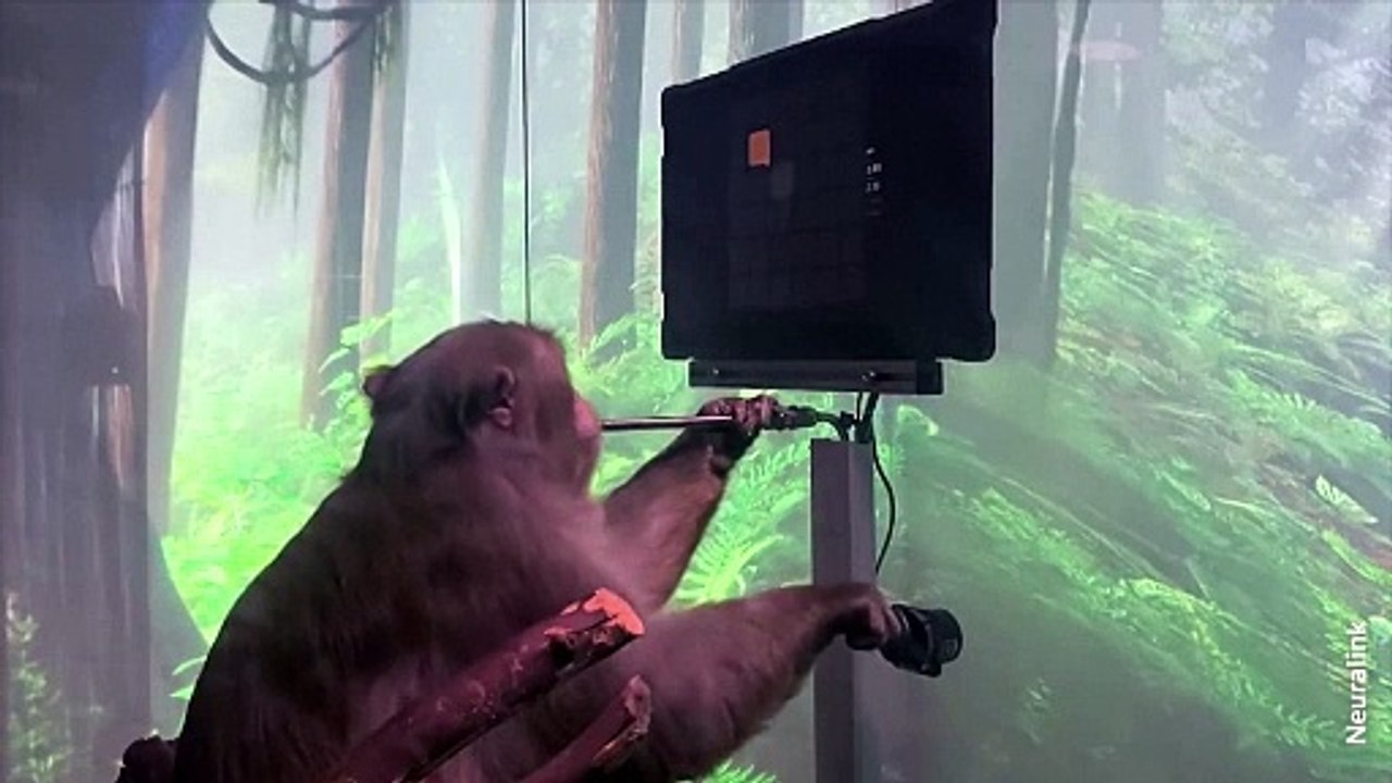 Musk's Neuralink implants brain chip in first human