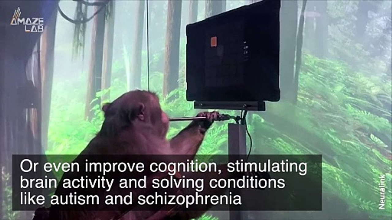 The First Human Has Reportedly Received a Neuralink Brain Implant