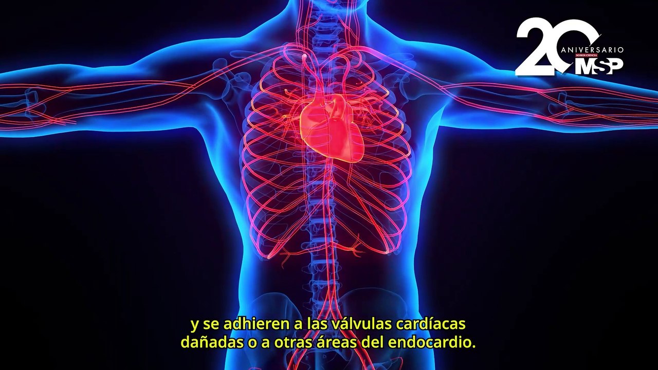 ¿Qué es y cómo funciona la endocarditis? - #ExclusivoMSP