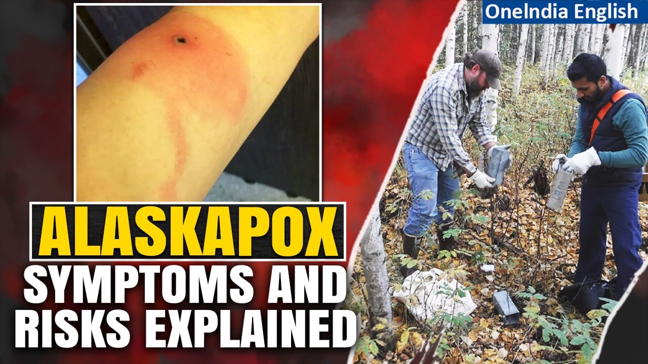 Alaskapox: Unraveling the Details of Alaska's Unusual Spreading Virus | Oneindia News