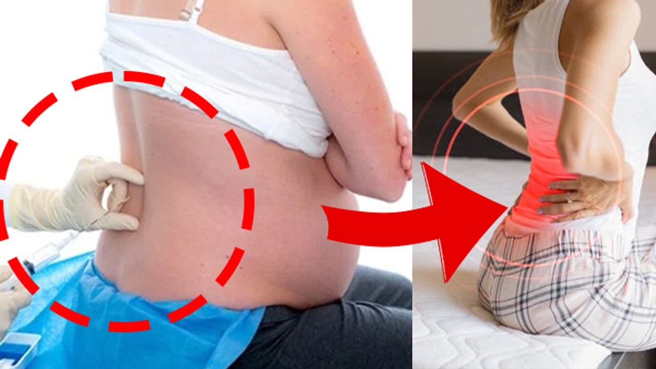C Section Delivery के बाद क्या Back Pain Reason है Anesthesia Injection, Quick Relief Treatment |