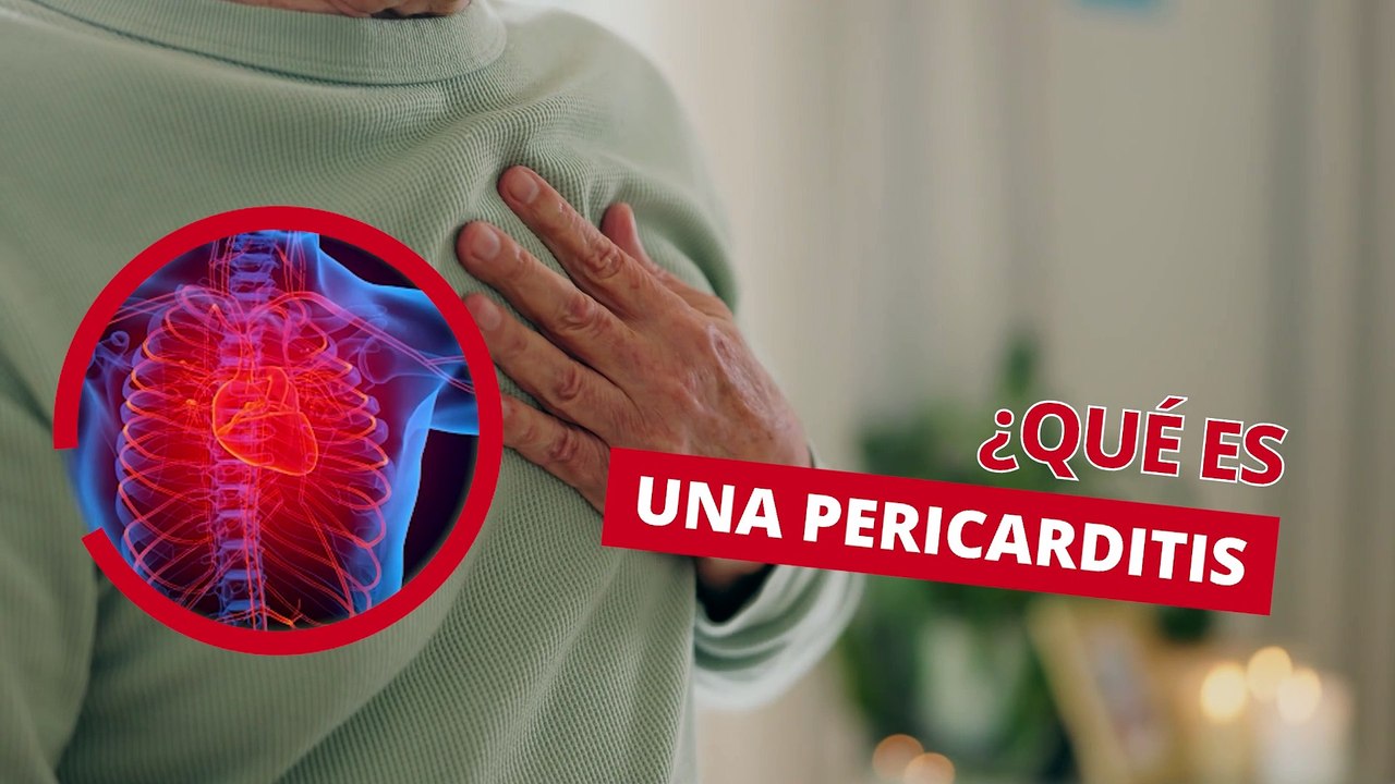 ¿Qué es una pericarditis y cómo funciona? - #EspecialMSP