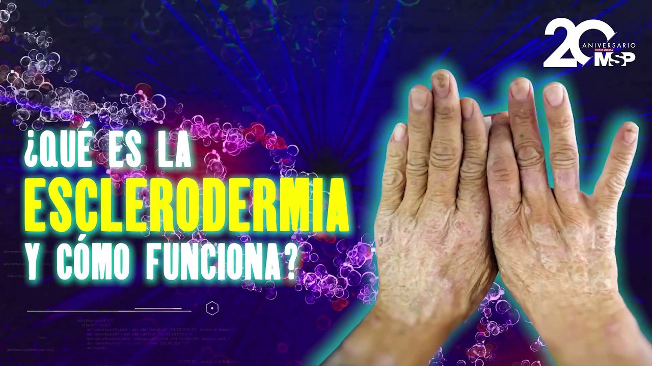 ¿Qué es la esclerodermia y cómo funciona? - #ExclusivoMSP