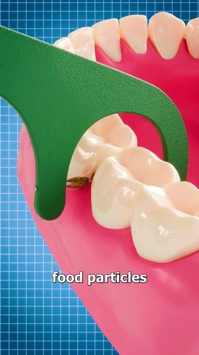 Why You Should Floss...