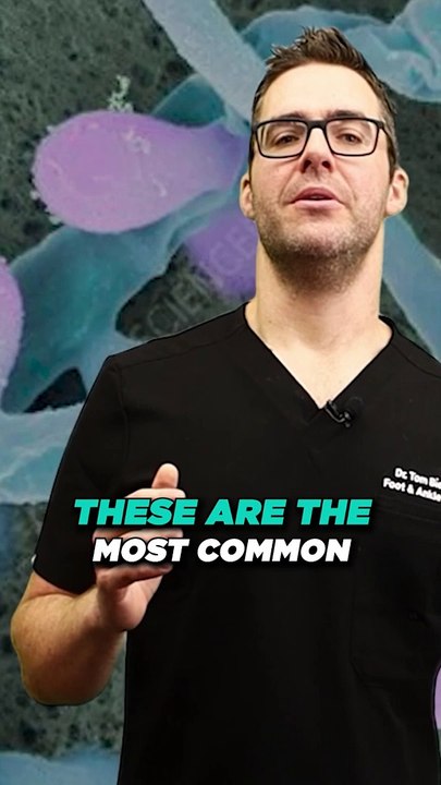 What are the Causes of Toenail FUNGUS