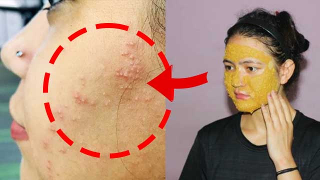 हल्दी को सीधे चेहरे पर लगाना सही होता है या नहीं | Chehre Par Haldi Lagane Se Kya Hota Hai | Boldsky