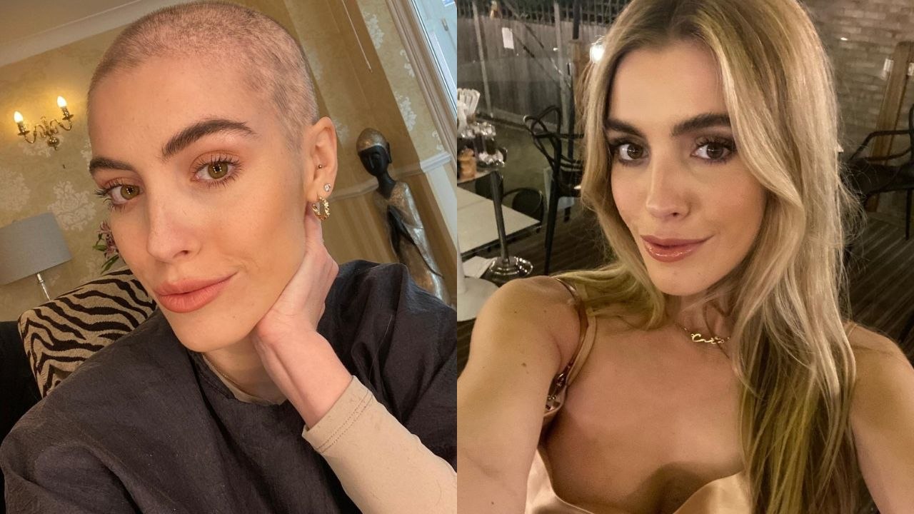 "I used to be an 'it girl' - then an avocado-sized tumour ruined my life"