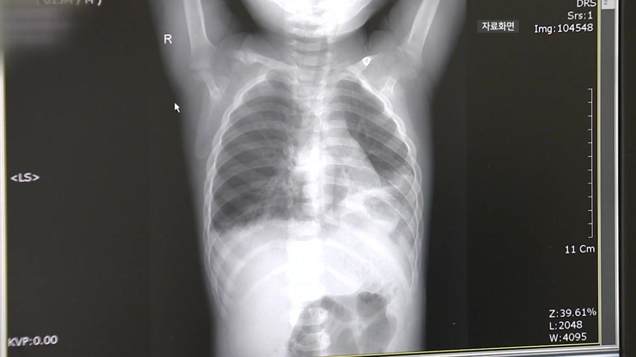 아동병원협회 "아동병원이 소아응급실 역할까지 수행" / YTN