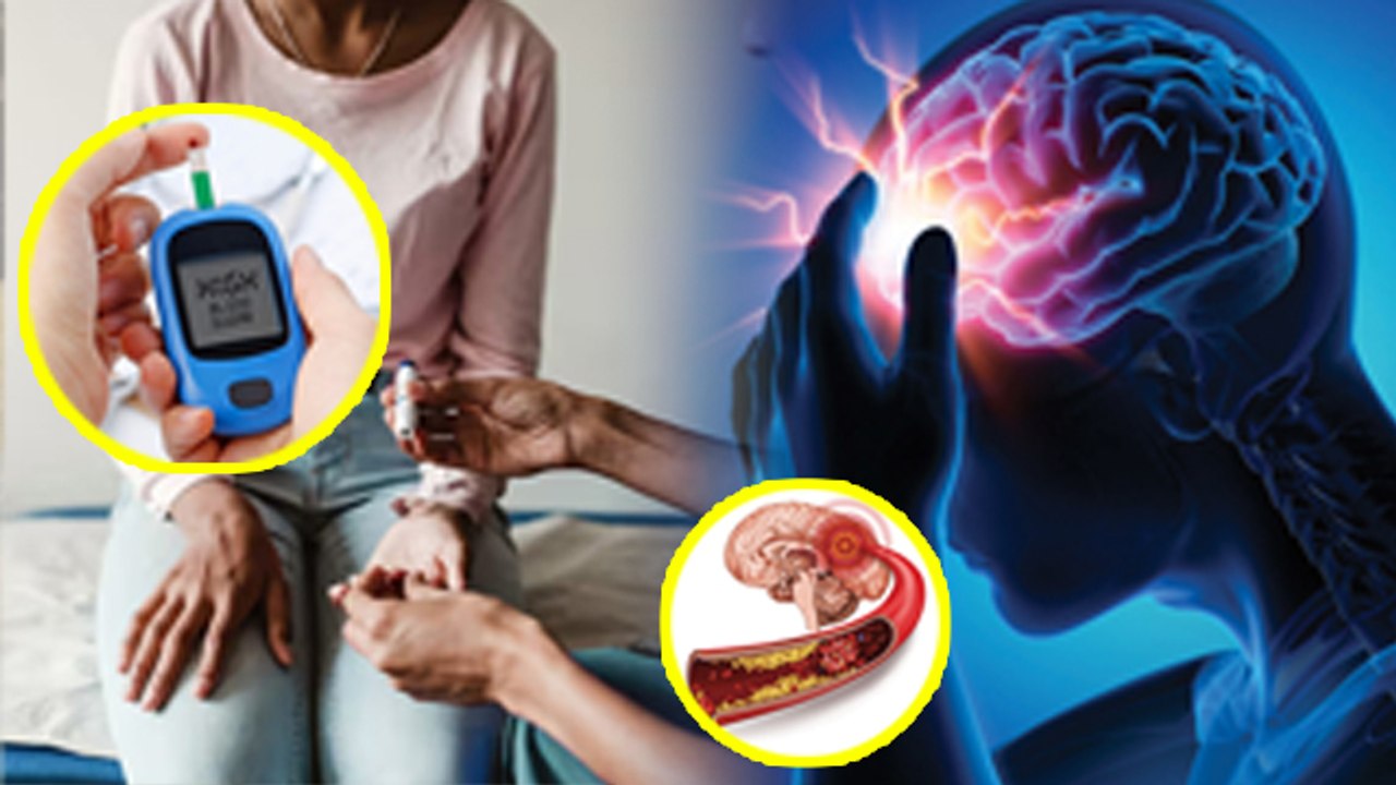 Diabetes Patient में High Risk Of Brain Stroke Reason | Relation Between Diabetes And Stroke