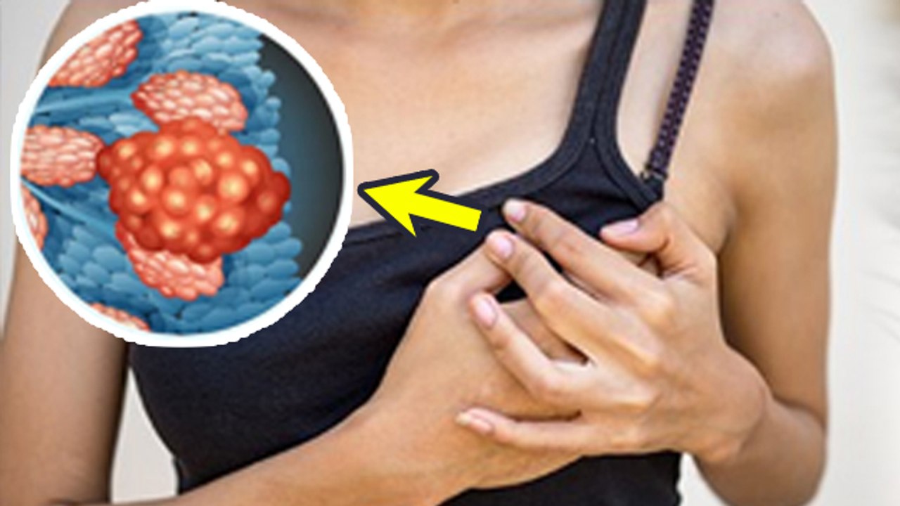 Breast Lump Treatment: ब्रेस्ट में अचानक गांठ महसूस होने पर सबसे पहले क्या करना चाहिए | Boldsky