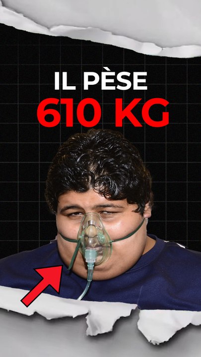 Sa perte de poids est folle