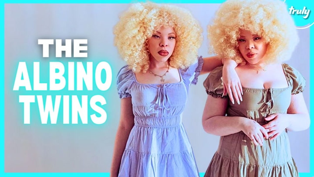 Identical Twins with Albinism: A Rare 1 in 2 Million Occurrence | BORN DIFFERENT