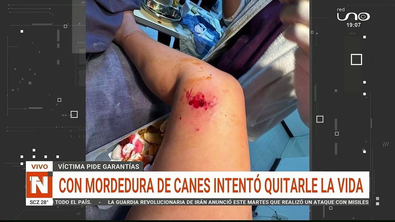 Tentativa de feminicidio