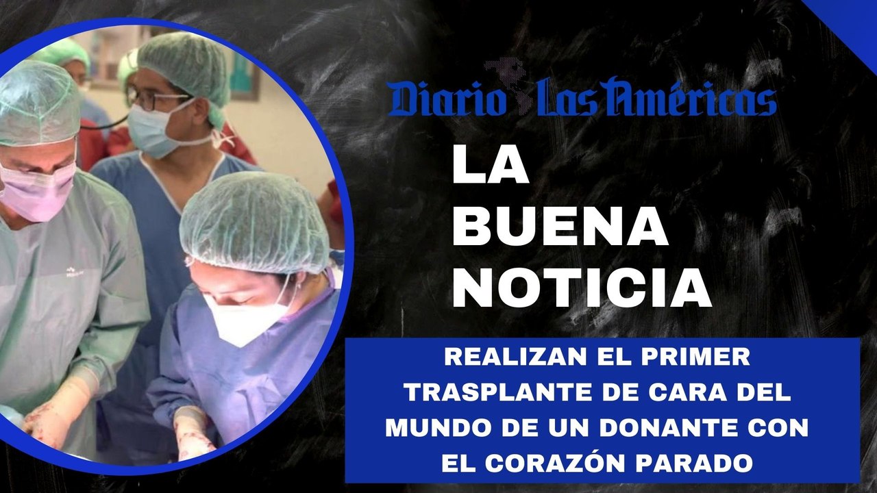 Realizan el Primer trasplante de cara del mundo de un donante con el corazón parado | La buena noticia