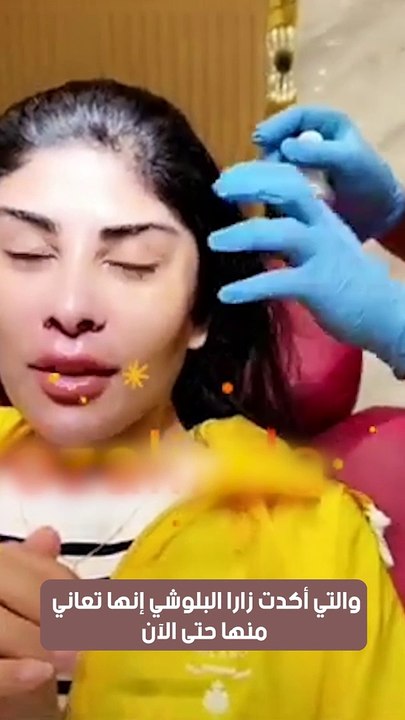 على خطى هند القحطاني.  زارا البلوشي بشفاه مشلولة