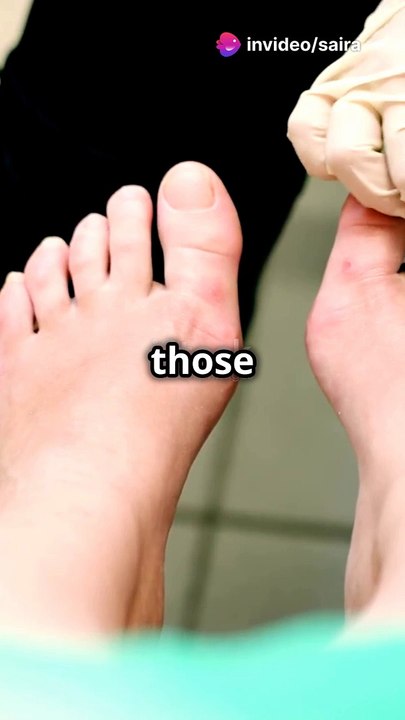 Feet nails cleaning hacks -dailymotion