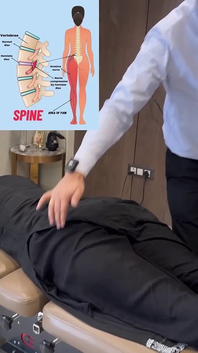 Sciatica pain treatment #dailymotion #shorts  #feed #feedshort #information #video
