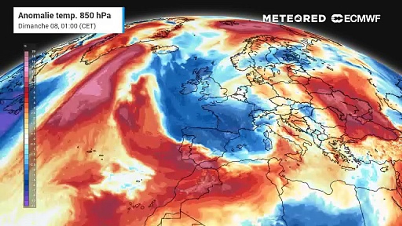 Anomalie température France