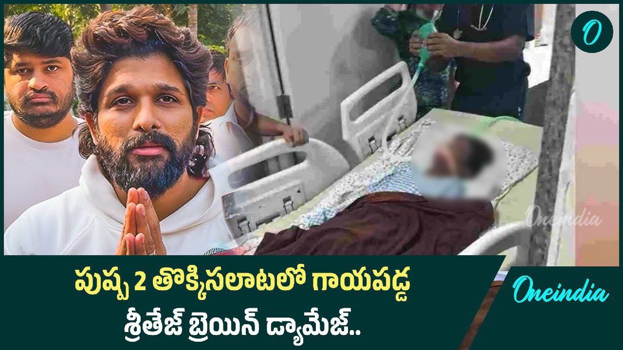 Pushpa 2 తొక్కిసలాటలో తీవ్రంగా గాయపడ్డ Sritej పరిస్థితి ఇంకా విషమం | Oneindia Telugu