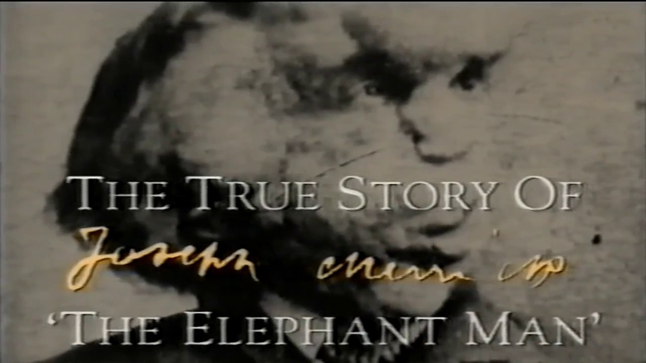 The Elephant Man: The Joseph Merrick Story