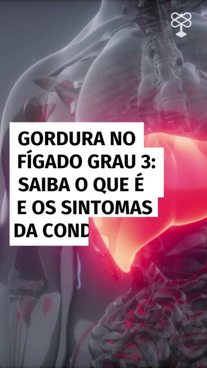 Gordura no fígado grau 3: saiba o que é e os sintomas da condição