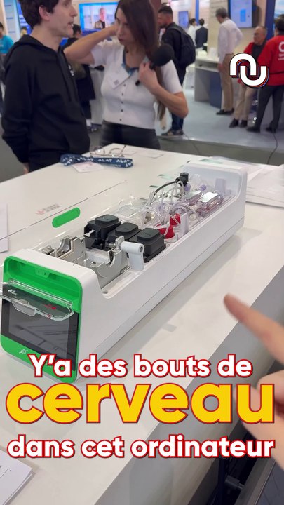 Des bouts de CERVEAU dans un ORDINATEUR