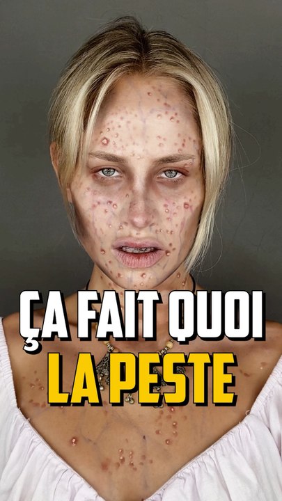 AVOIR LA PESTE ?!
