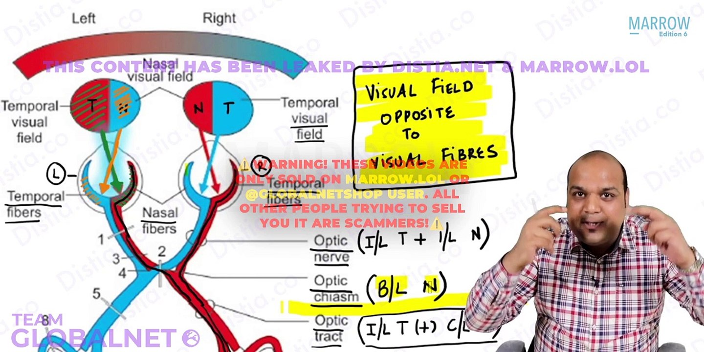 06. Neuro-Ophtha-Visual pathway and Visual field defects