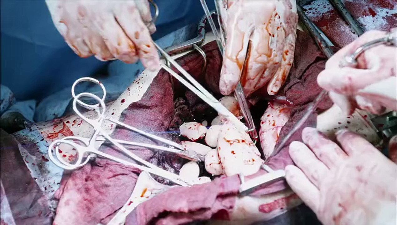 Blood Episode 2 [ENG SUB] – Intense Korean Medical Supernatural Drama