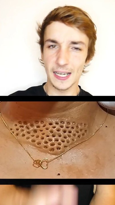 Tu as cette phobie ?