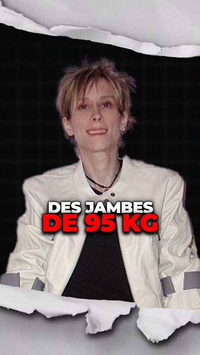 Ses jambes n'arrêtent pas de grossir...