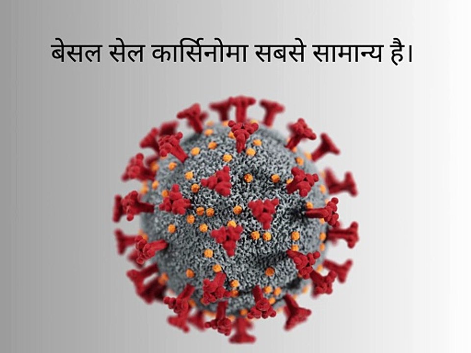 Types of Skin Cancer – Understanding Different Forms of Skin Cancer