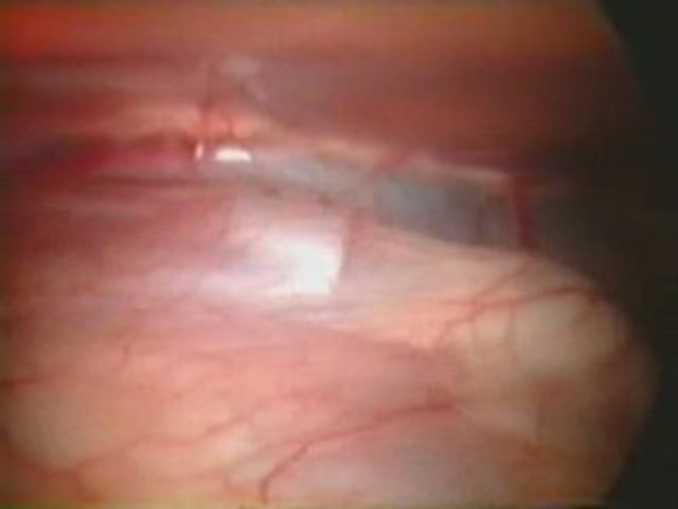 Le 5 Minutes - 31 Juillet 2007 📺